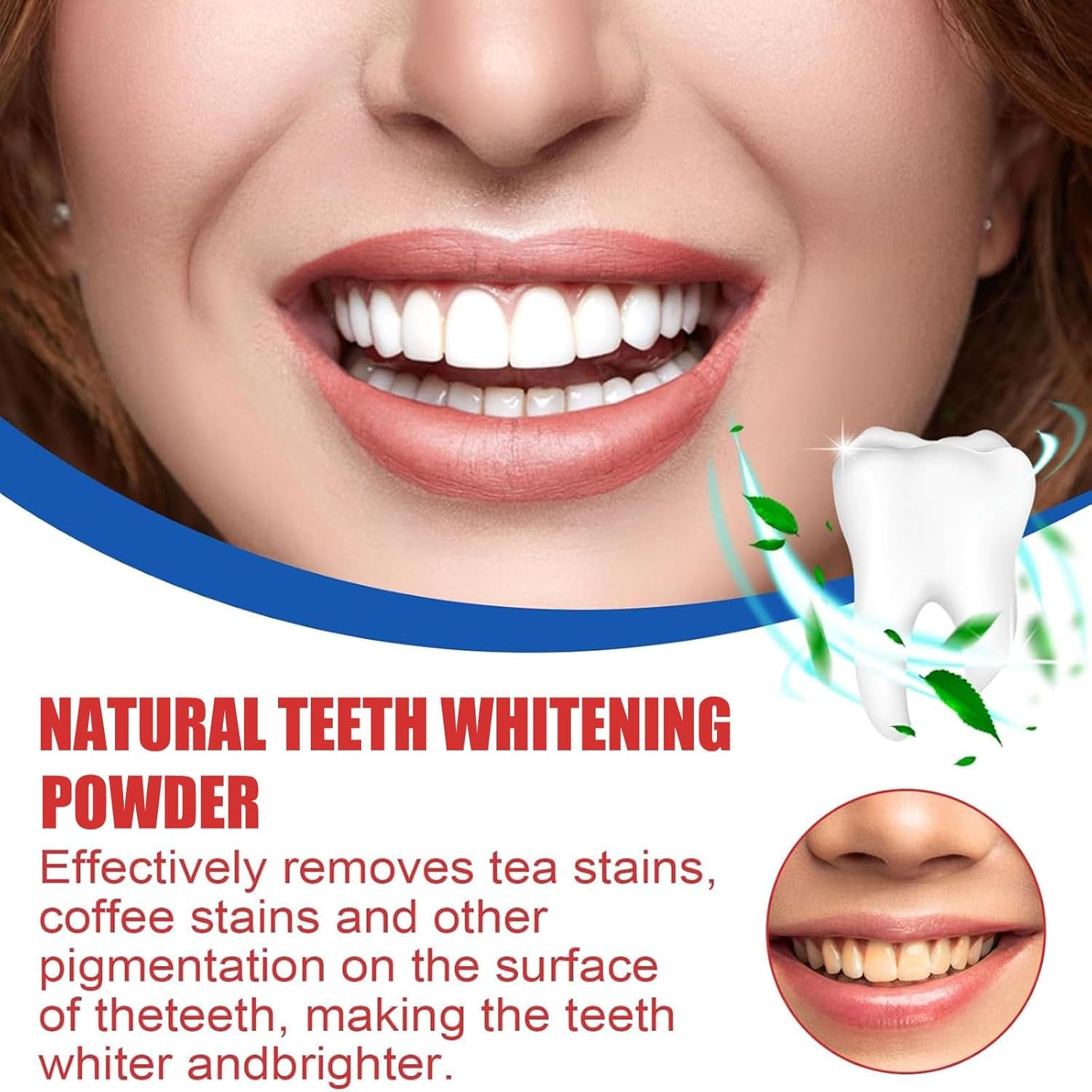 Natural Teeth Whitening Powder for a Radiant Smile