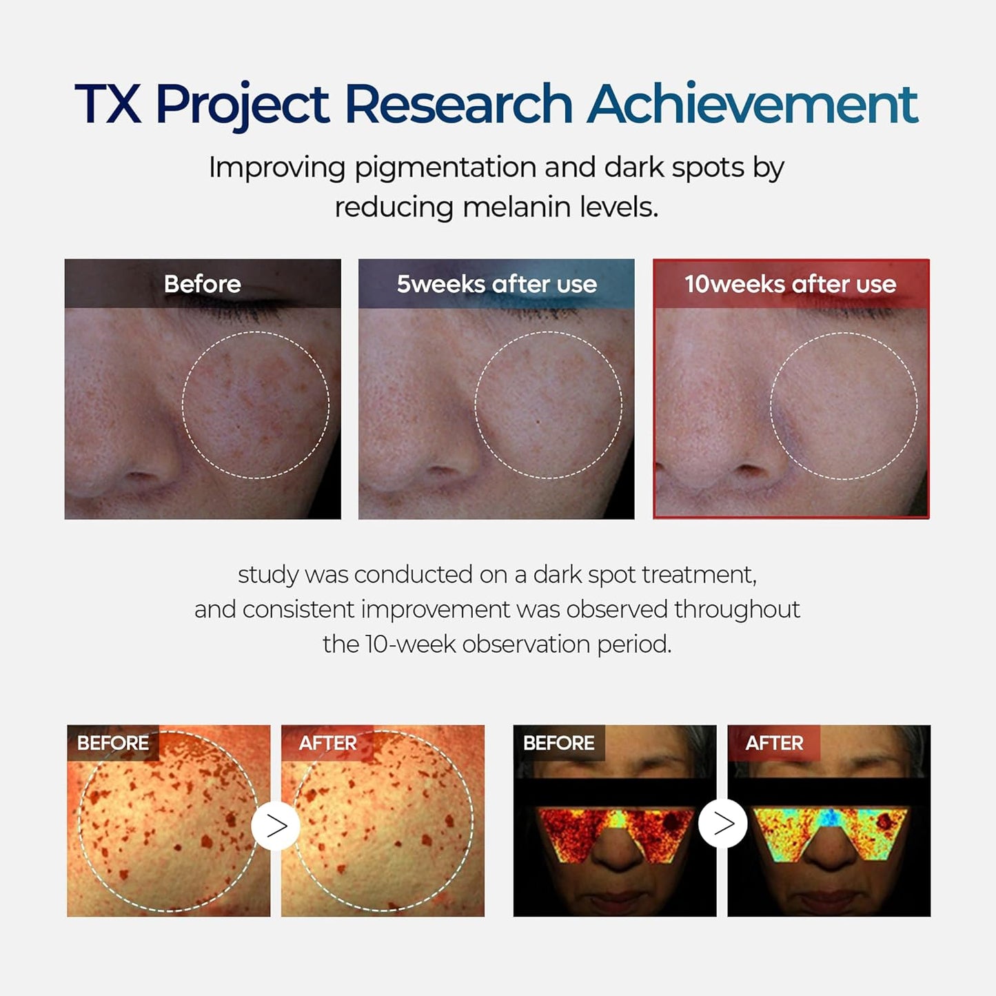 GlowFade™ TX Tranexamic Acid Cream – Korean Anti-Pigmentation & Freckle Corrector for Clear, Even-Toned Skin (50ml)